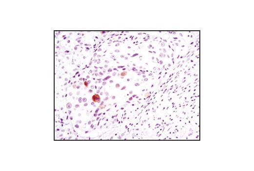 Immunohistochemistry Image 1: Phospho-Chk2 (Thr68) (C13C1) Rabbit mAb (BSA and Azide Free)