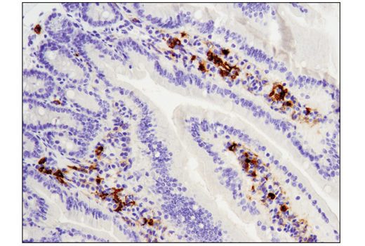 Immunohistochemistry Image 1: TIM-3 (D3M9R) XP<sup>®</sup> Rabbit mAb (BSA and Azide Free)