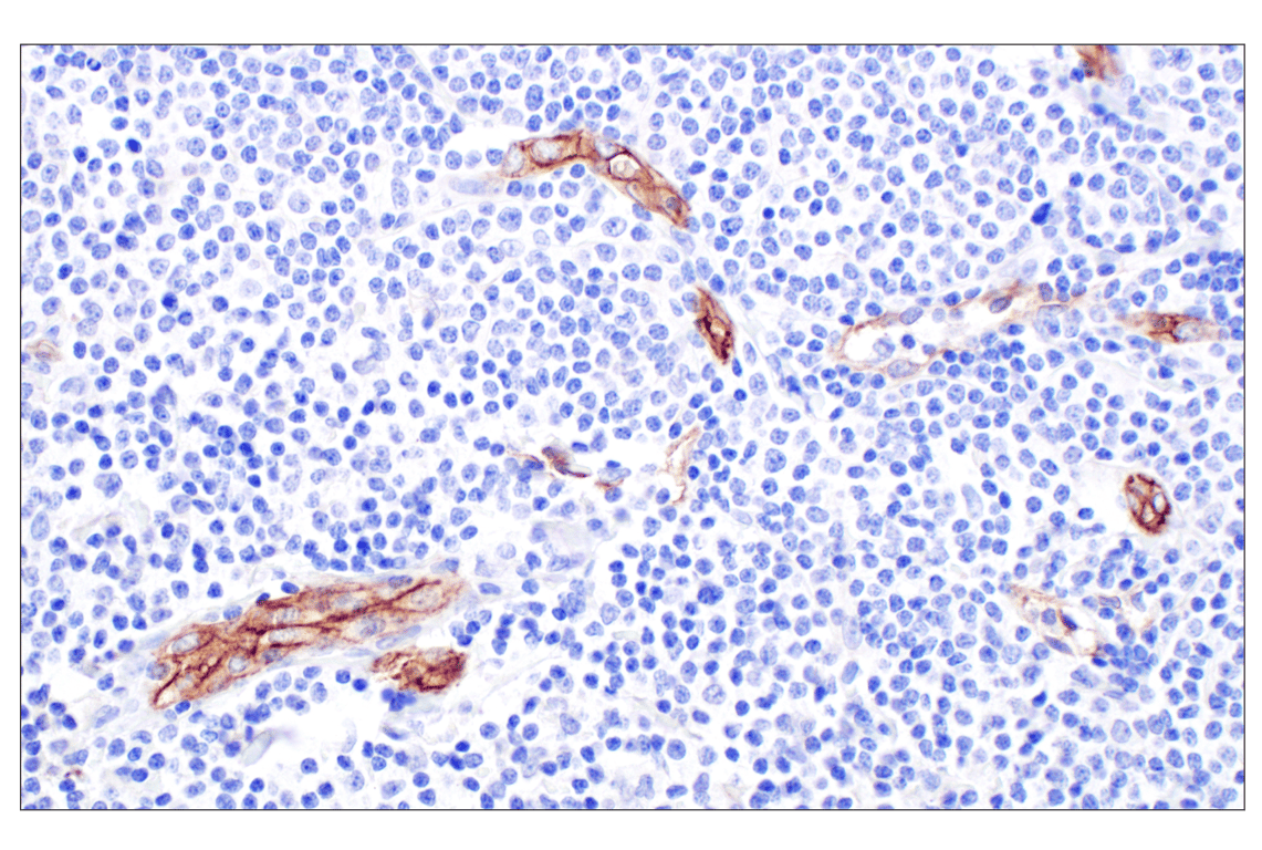 Immunohistochemistry Image 2: CD105/Endoglin (F9C5Q) Rabbit mAb