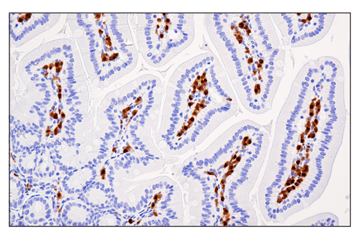 Immunohistochemistry Image 2: IRF-4 (E8H3S) XP<sup>®</sup> Rabbit mAb (BSA and Azide Free)