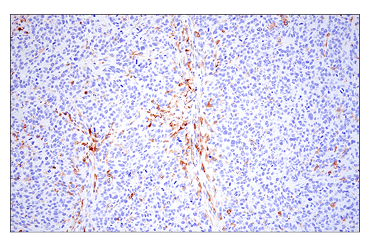 Immunohistochemistry Image 2: CD86 (E5W6H) Rabbit mAb