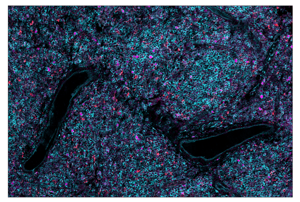 Immunohistochemistry Image 2: PCNA (D3H8P) & CO-0090-488 SignalStar<sup>™</sup> Oligo-Antibody Pair