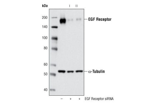 undefined Image 1: SignalSilence<sup>®</sup> EGF Receptor siRNA I