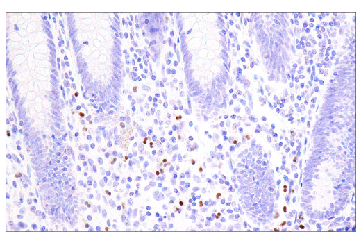 Immunohistochemistry Image 3: Olig2 (E6G6Q) XP<sup>®</sup> Rabbit mAb (BSA and Azide Free)