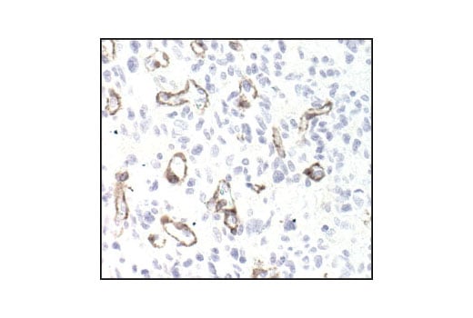Immunohistochemistry Image 2: PDGF Receptor β (28E1) Rabbit mAb