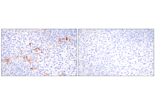 Immunohistochemistry Image 5: iNOS (E1W4J) Rabbit mAb