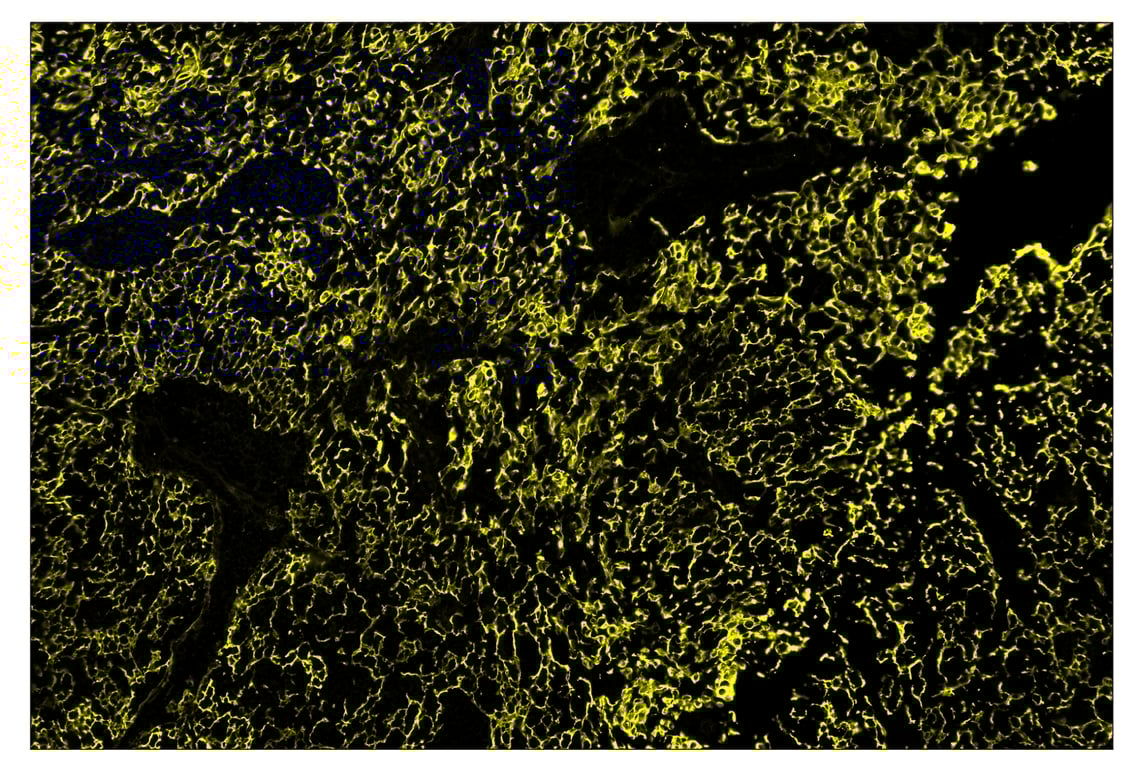 Immunohistochemistry Image 3: Pan-Keratin (Type I) (E6S1S) & CO-0072-594 SignalStar<sup>™</sup> Oligo-Antibody Pair