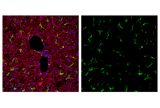 Immunofluorescence Image 2: Iba1/AIF-1 (E4O4W) XP<sup>®</sup> Rabbit mAb (Alexa Fluor<sup>®</sup> 488 Conjugate)