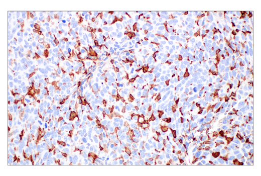 Immunohistochemistry Image 2: CD206/MRC1 (E6T5J) XP<sup>®</sup> Rabbit mAb (BSA and Azide Free)