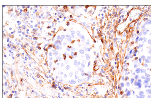 Immunohistochemistry Image 7: Integrin α1/CD49a (E9K2J) XP<sup>®</sup> Rabbit mAb (BSA and Azide Free)