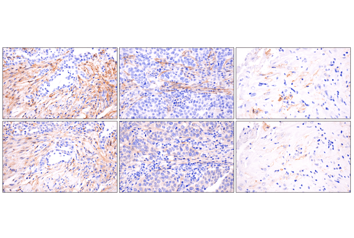Immunohistochemistry Image 9: LRRC15 (E4X8J) Rabbit mAb