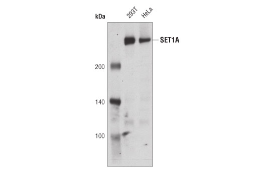 Western Blotting Image 1: SET1A (D3V9S) Rabbit mAb
