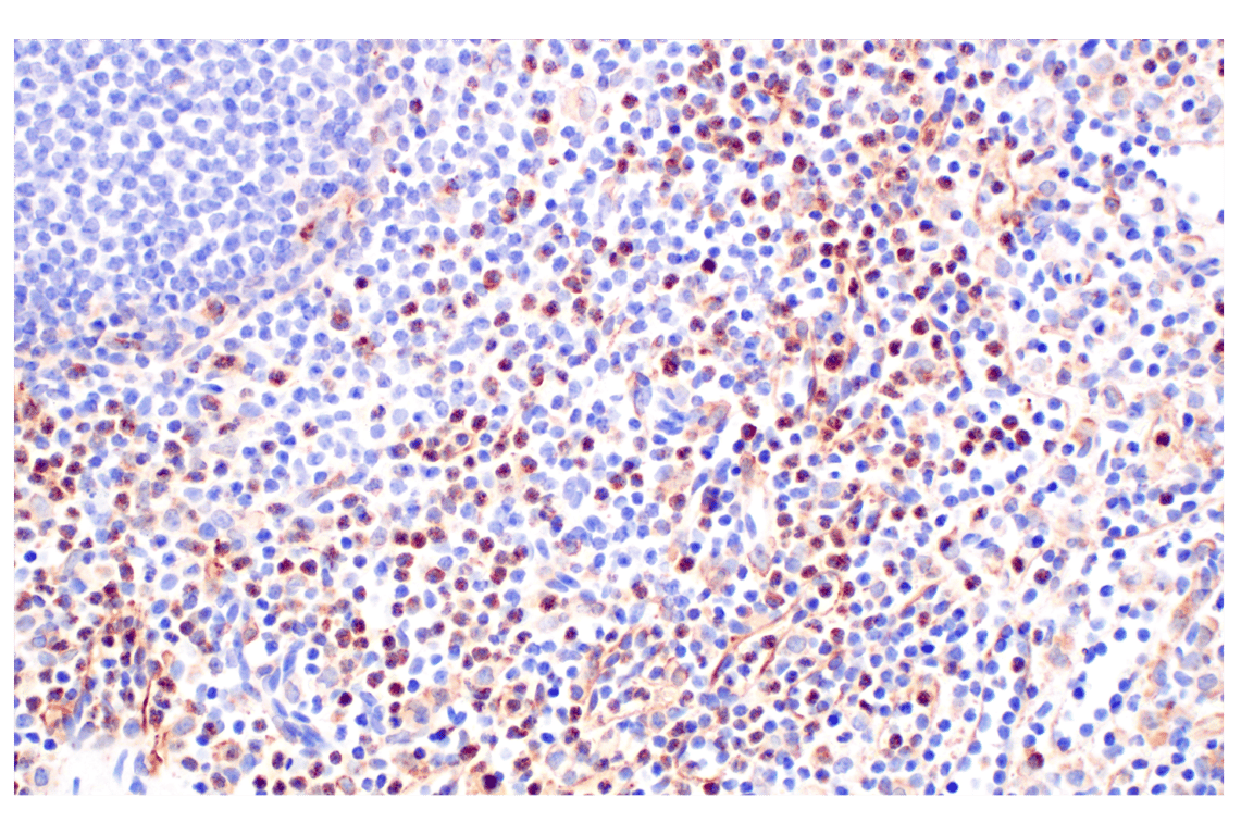 Immunohistochemistry Image 5: VISTA (D1L2G<sup>™</sup>) XP<sup>®</sup> Rabbit mAb (BSA and Azide Free)