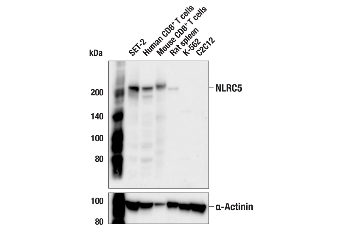 Western Blotting Image 1: NLRC5 (E1E9Y) Rabbit mAb