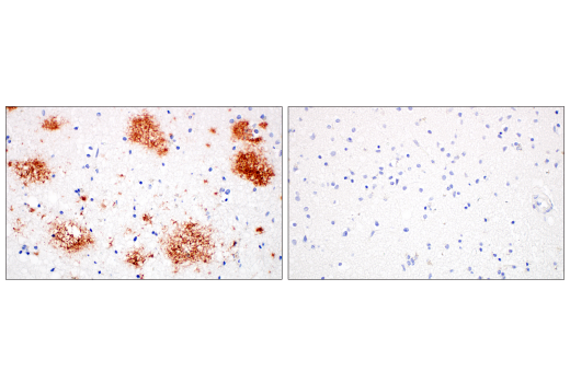 Immunohistochemistry Image 2: β-Amyloid (1-42) (E6D5M) Rabbit mAb