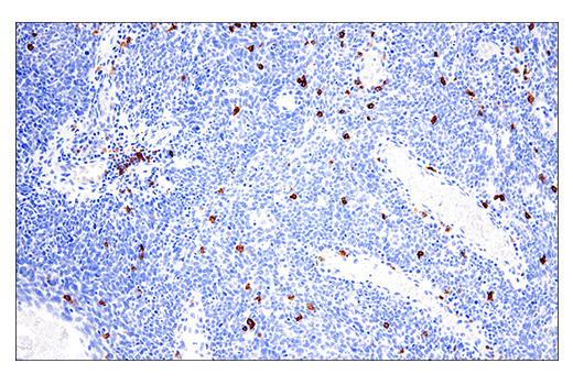 Immunohistochemistry Image 3: CD20 (E7B7T) XP<sup>®</sup> Rabbit mAb