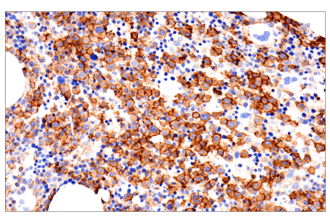 Immunohistochemistry Image 1: CD38 (E7Z8C) XP<sup>®</sup> Rabbit mAb (BSA and Azide Free)