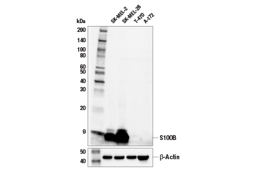 Western Blotting Image 1: S100B (E7C3A) Rabbit mAb