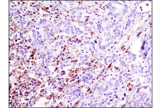 undefined Image 6: PhosphoPlus<sup>®</sup> Btk (Tyr223) Antibody Duet