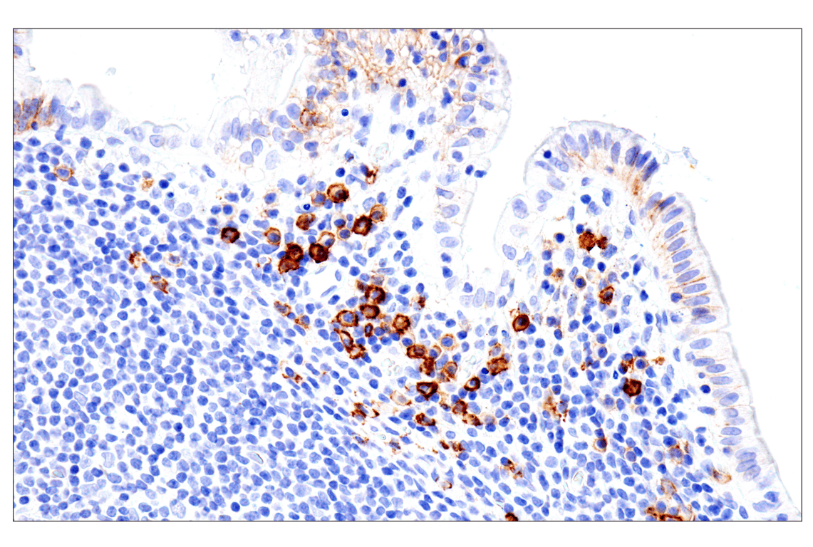 Immunohistochemistry Image 10: Syndecan 1 (E7F7T) Rabbit mAb