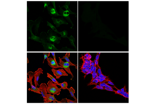 Immunofluorescence Image 1: Notch2 (D76A6) XP<sup>®</sup> Rabbit mAb (Alexa Fluor<sup>®</sup> 488 Conjugate)