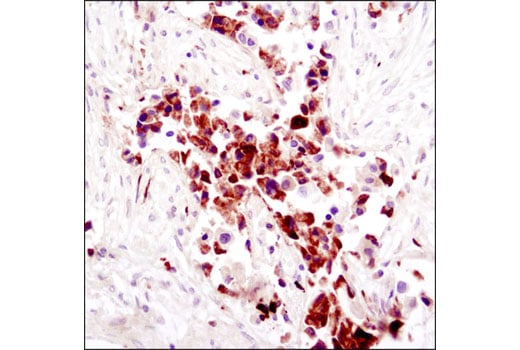 Immunohistochemistry Image 1: FGF Receptor 1 (D8E4) XP<sup>®</sup> Rabbit mAb (BSA and Azide Free)