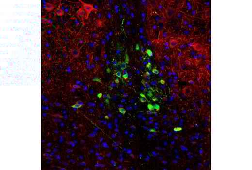 Immunofluorescence Image 1: CART (D6L8J) Rabbit mAb