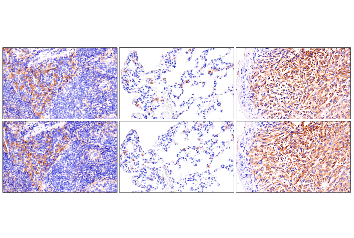 Immunohistochemistry Image 6: Axl (E3Z2H) Rabbit mAb (BSA and Azide Free)