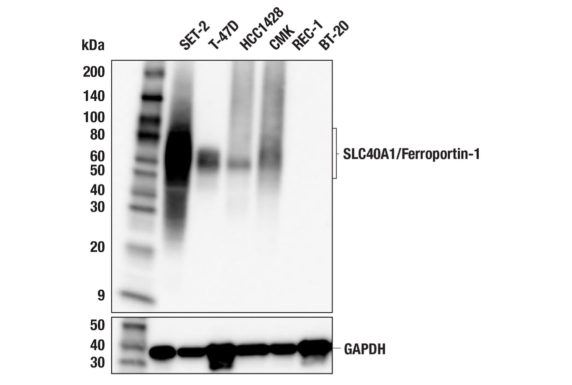 Western Blotting Image 1: SLC40A1/Ferroportin-1 (F4A2M) Rabbit mAb