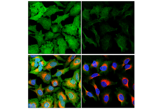 Immunofluorescence Image 1: CDK5 (D1F7M) Rabbit mAb
