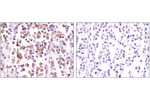 Immunohistochemistry Image 2: BLNK (D3P2H) XP<sup>®</sup> Rabbit mAb (BSA and Azide Free)