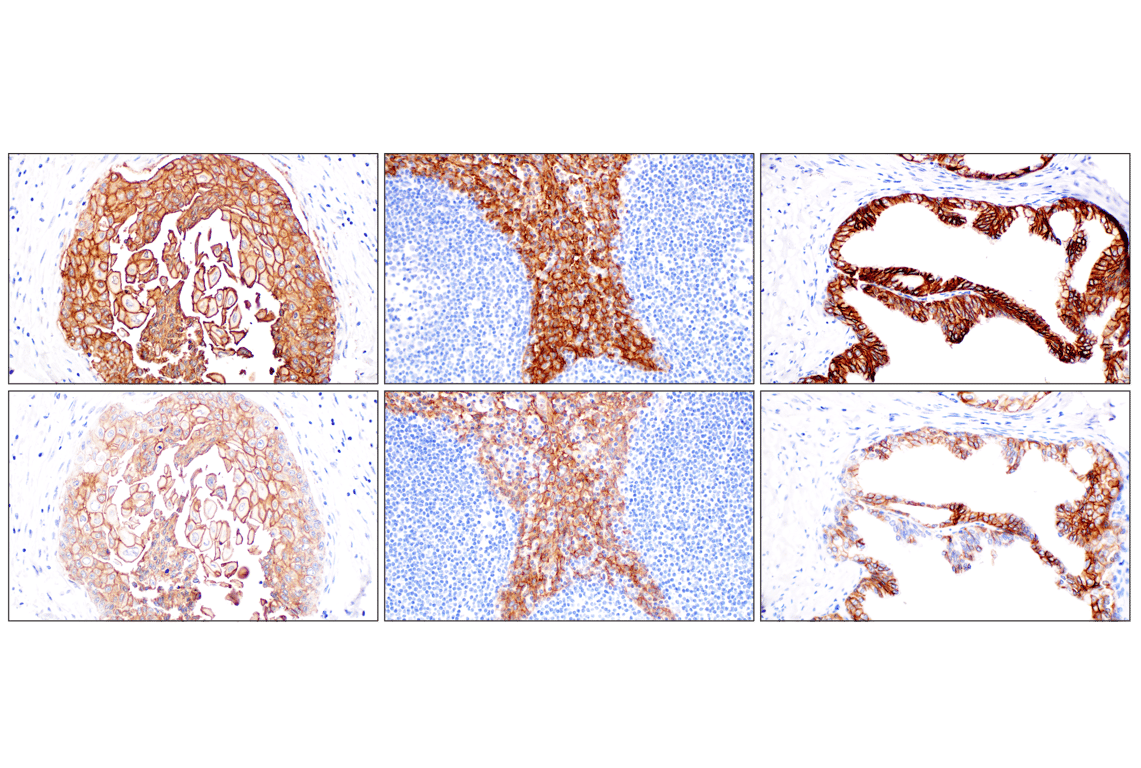 Immunohistochemistry Image 10: TACSTD2/TROP2 (F4W4J) Rabbit mAb (BSA and Azide Free)