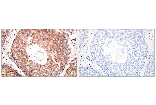Immunohistochemistry Image 11: TFAM (D5C8) Rabbit mAb