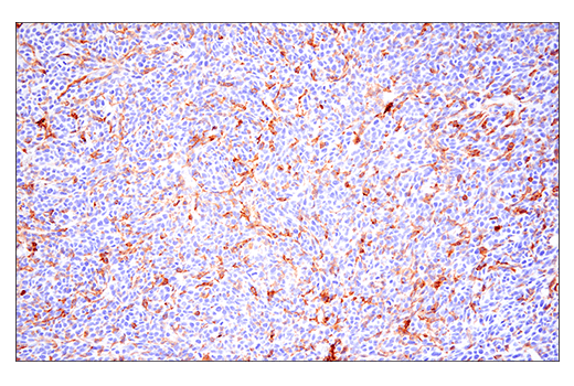 Immunohistochemistry Image 1: CD86 (E5W6H) Rabbit mAb