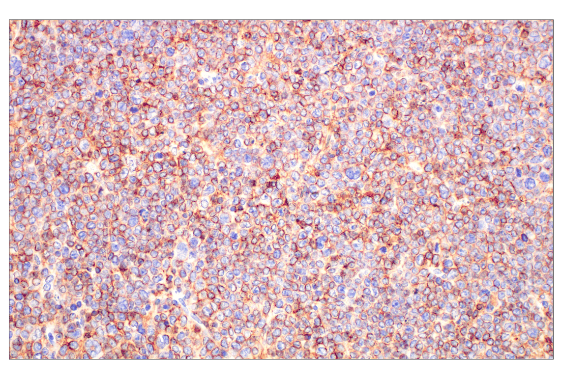 Immunohistochemistry Image 1: CD20 (E3N7O) XP<sup>®</sup> Rabbit mAb