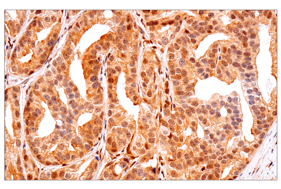 Immunohistochemistry Image 3: PTEN (D4.3) XP<sup>®</sup> Rabbit mAb (BSA and Azide Free)