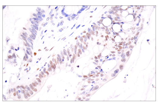Immunohistochemistry Image 4: HIF-1α (E1V6A) Rabbit mAb