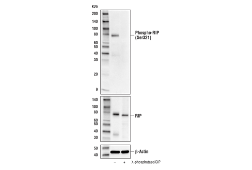 Western Blotting Image 2: Phospho-RIP (Ser321) (E9K2A) Rabbit mAb