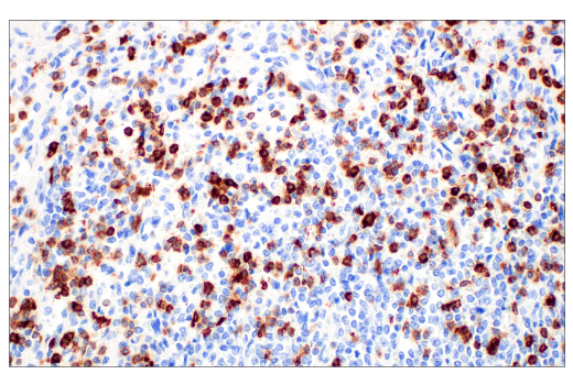 Immunohistochemistry Image 1: CD7 (E4G1Q) XP<sup>®</sup> Rabbit mAb