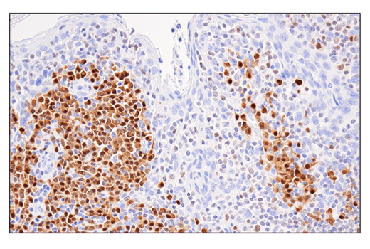 Immunohistochemistry Image 5: IRF-4 (E8H3S) XP<sup>®</sup> Rabbit mAb (BSA and Azide Free)