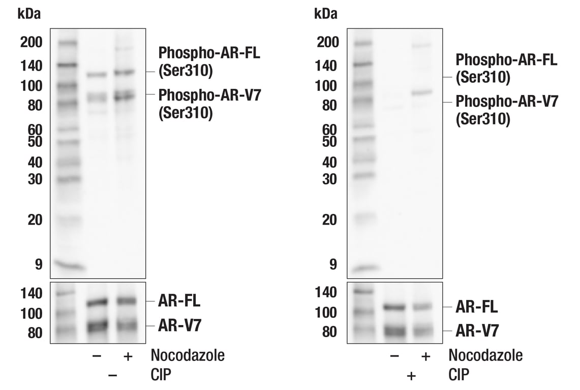 Western Blotting Image 1: Phospho-Androgen Receptor (Ser310) (E7L2S) Rabbit mAb