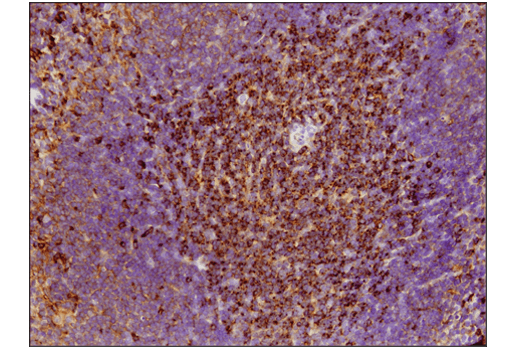 Immunohistochemistry Image 4: VISTA (D5L5T) XP<sup>®</sup> Rabbit mAb