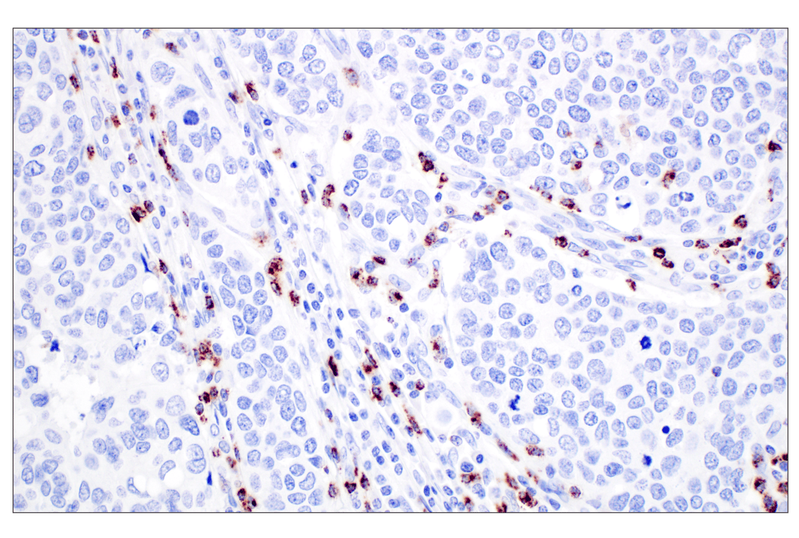 Immunohistochemistry Image 2: NKG7 (F4V5I) Rabbit mAb (BSA and Azide Free)