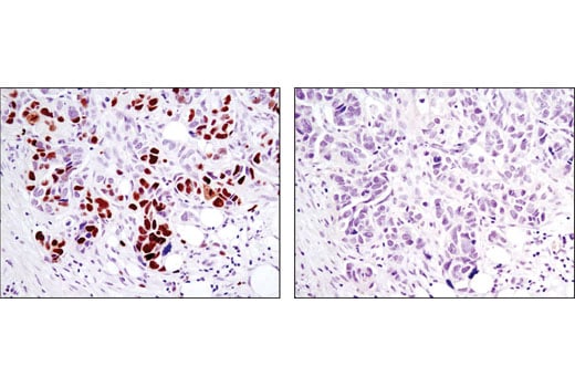 Immunohistochemistry Image 4: Phospho-Rb (Ser807/811) (D20B12) XP<sup>®</sup> Rabbit mAb