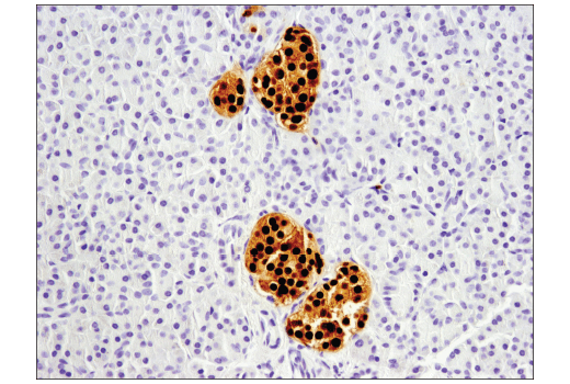 Immunohistochemistry Image 4: Pax6 (D3A9V) XP<sup>®</sup> Rabbit mAb