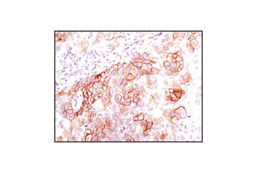 Immunohistochemistry Image 4: Phospho-Met (Tyr1234/1235) (D26) XP<sup>®</sup> Rabbit mAb (BSA and Azide Free)