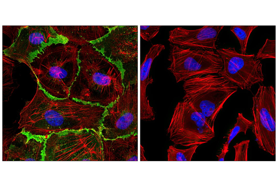 Immunofluorescence Image 1: CD31 (PECAM-1) (89C2) Mouse mAb