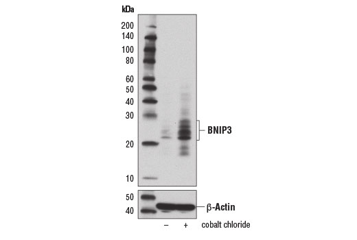 Western Blotting Image 1: BNIP3 Antibody