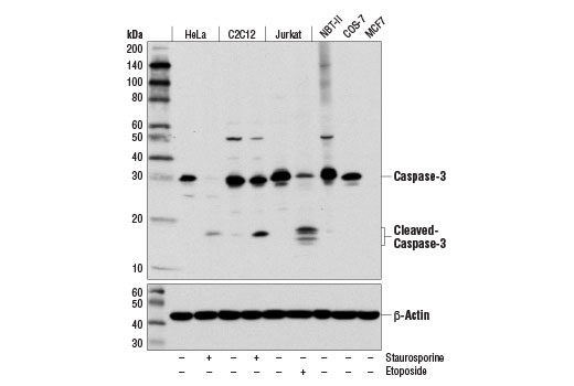 undefined Image 1: Apoptosis Antibody Sampler Kit II