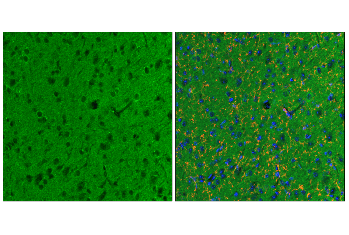 Immunofluorescence Image 2: Numb (C29G11) Rabbit mAb